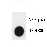 Dot blot of anti-Phospho-JMJD2A-Y547 Phospho-specific antibody on nitrocellulose membrane. 50ng of Phospho-peptide or Non Phospho-peptide per dot were adsorbed. Antibody working concentrations are 0.5ug per ml.