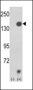 Western blot of JMJD2A(arrow) using rabbit polyclonal JMJD2A. 293 cell lysates (2 ug/lane) either nontransfected (Lane 1) or transiently transfected with the JMJD2A gene (Lane 2) (Origene Technologies).