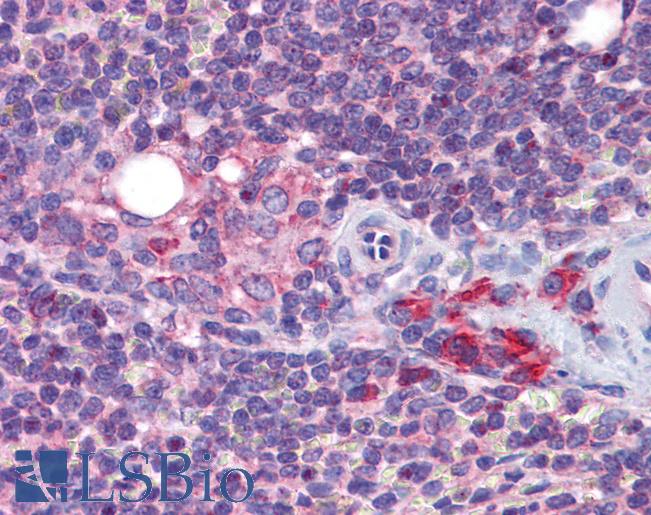 Anti-KDM4A / JMJD2A antibody IHC of human spleen. Immunohistochemistry of formalin-fixed, paraffin-embedded tissue after heat-induced antigen retrieval. Antibody LS-B5034 concentration 5 ug/ml.