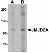 Western blot of JMJD2A in rat liver tissue lysate with JMJD2A antibody at (A) 1 and (B) 2 ug/ml.