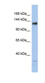 KDM4B / JMJD2B antibody LS-C112169 Western blot of Fetal Kidney lysate.