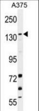 JMJD2B Antibody western blot of A375 cell line lysates (35 ug/lane). The JMJD2B antibody detected the JMJD2B protein (arrow).