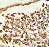 Formalin-fixed and paraffin-embedded human Testis tissue reacted with JMJD2B Antibody , which was peroxidase-conjugated to the secondary antibody, followed by DAB staining. This data demonstrates the use of this antibody for immunohistochemistry; clinical relevance has not been evaluated.