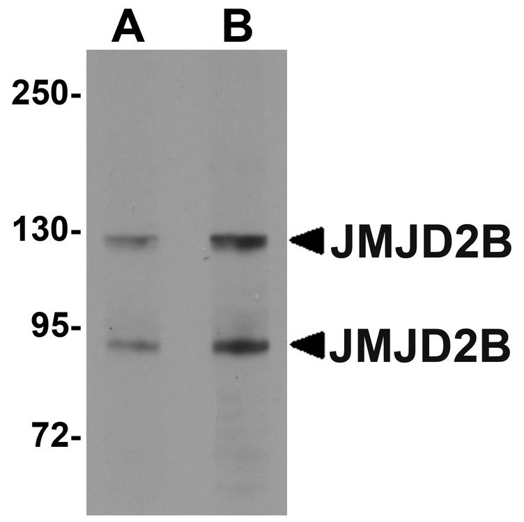 Western blot analysis of JMJD2B in A20 cell lysate with JMJD2B antibody at (A) 1 and (B) 2 ug/ml.