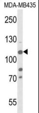 Western blot of JMJD2B-T305 in MDA-MB435 cell line lysates (35 ug/lane). JMJD2B (arrow) was detected using the purified antibody.