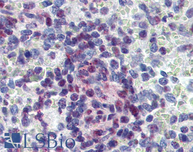 Anti-JMJD2C antibody IHC of human spleen. Immunohistochemistry of formalin-fixed, paraffin-embedded tissue after heat-induced antigen retrieval. Antibody LS-B3975 concentration 5 ug/ml.
