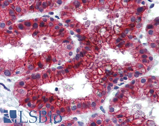 Anti-JMJD2C antibody IHC of human prostate. Immunohistochemistry of formalin-fixed, paraffin-embedded tissue after heat-induced antigen retrieval. Antibody LS-B3975 concentration 5 ug/ml.