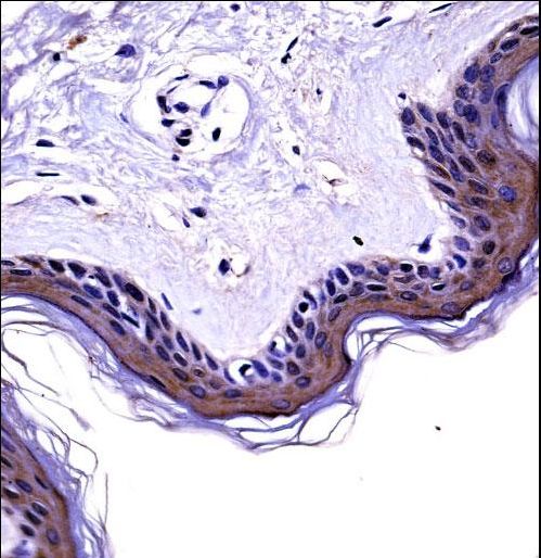 NCK2 Antibody immunohistochemistry of formalin-fixed and paraffin-embedded human skin tissue followed by peroxidase-conjugated secondary antibody and DAB staining.