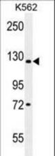 JMJD2C Antibody western blot of K562 cell line lysates (35 ug/lane). The JMJD2C antibody detected the JMJD2C protein (arrow).