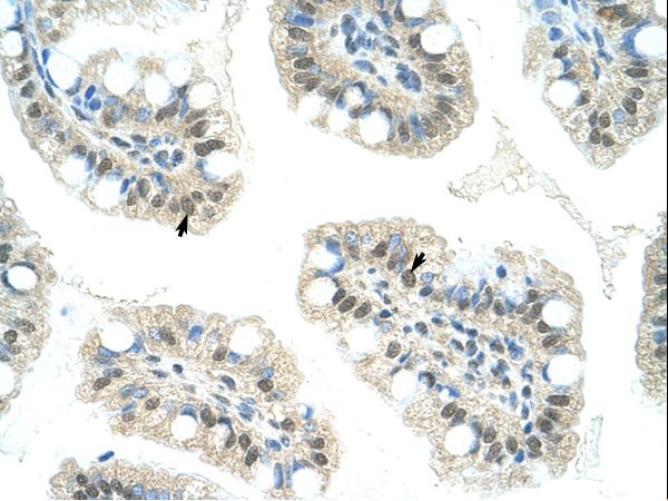 KDM4D / JMJD2D antibody LS-C30452 was used in IHC to stain formalin-fixed, paraffin-embedded human intestine.