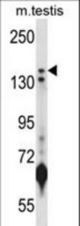 JARID1B Antibody western blot of mouse testis tissue lysates (35 ug/lane). The JARID1B antibody detected the JARID1B protein (arrow).