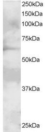 Antibody staining (2 ug/ml) of A431 lysate (RIPA buffer, 30 ug total protein per lane). Primary incubated for 1 hour. Detected by Western blot of chemiluminescence.