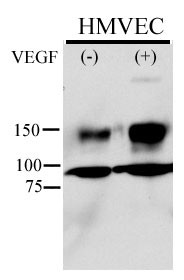Anti-Phospho-KDR/FLK1-Y996 antibody is used in Western blot to detect Phospho-KDR/FLK1-Y996 in HMVEC cell line lysate. Endothelial cells were stimulated with 50 ug/ml VEGF for 5min; 20ug lysate from HMVEC was loaded onto an 8% gel; for Western blot, membranes were incubated O/N with Phospho-KDR/FLK1-Y996 Antibody diluted to 1:500 in 1% Milk/TBST. Data and Protocol kindly provided by Dr. Weis from Cheresh Lab, UCSD.