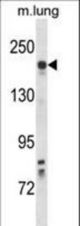 Mouse Kdr Antibody western blot of mouse lung tissue lysates (35 ug/lane). The Kdr antibody detected the Kdr protein (arrow).