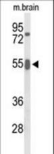 Western blot of GRB7 Antibody in mouse brain tissue lysates (35 ug/lane). GRB7 (arrow) was detected using the purified antibody.
