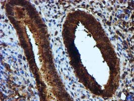 IHC of paraffin-embedded Human endometrium tissue using anti-KEAP1 mouse monoclonal antibody.