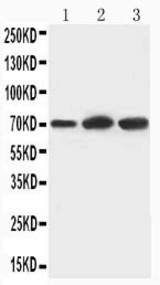 WB of KEAP1 antibody. All lanes: Anti-KEAP1 at 0.5ug/ml. Lane 1: U87 Whole Cell Lysate at 40ug. Lane 2: HT1080 Whole Cell Lysate at 40ug. Lane 3: PANC Whole Cell Lysate at 40ug. Predicted bind size: 70KD. Observed bind size: 70KD.