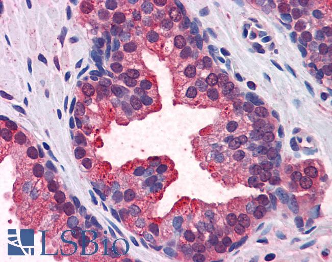 Anti-KEAP1 antibody IHC of human prostate. Immunohistochemistry of formalin-fixed, paraffin-embedded tissue after heat-induced antigen retrieval. Antibody LS-B5612 concentration 5 ug/ml.
