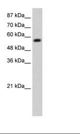 Transfected Cell Lysate.