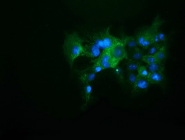 Anti-KEAP1 mouse monoclonal antibody immunofluorescent staining of COS7 cells transiently transfected by pCMV6-ENTRY KEAP1.