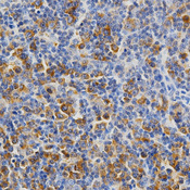Immunohistochemistry of paraffin-embedded rat spleen using KEAP1 antibody at dilution of 1:200 (x400 lens)