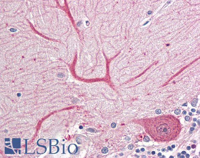 Anti-KEAP1 antibody IHC of human brain, cerebellum. Immunohistochemistry of formalin-fixed, paraffin-embedded tissue after heat-induced antigen retrieval. Antibody LS-B8363 dilution 3.75 ug/ml.