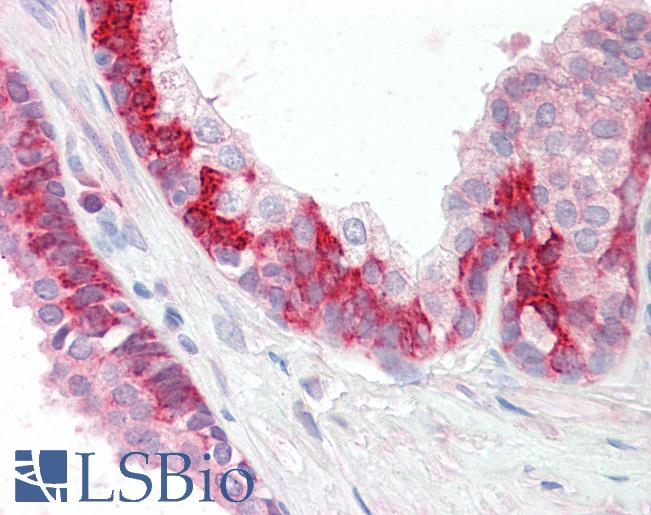 Anti-KEAP1 antibody IHC staining of human prostate. Immunohistochemistry of formalin-fixed, paraffin-embedded tissue after heat-induced antigen retrieval.