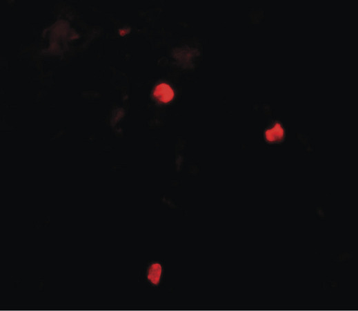 Immunofluorescence of KEAP1 in human lung tissue with KEAP1 antibody at 20 ug/ml.