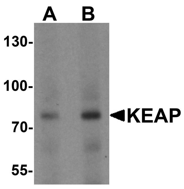 Western blot analysis of KEAP1 in human lung tissue lysate with KEAP1 antibody at (A) 1 and (B) 2 ug/ml.