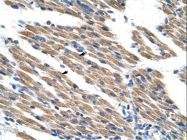 KEAP1 antibody LS-C30395 was used in IHC to stain formalin-fixed, paraffin-embedded human muscle.