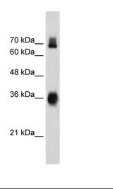 HepG2 Cell Lysate