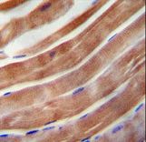 KEAP1 antibody immunohistochemistry of formalin-fixed and paraffin-embedded human skeletal muscle followed by peroxidase-conjugated secondary antibody and DAB staining.