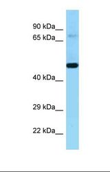Western blot of Human 721_B . KEL antibody dilution 1.0 ug/ml.