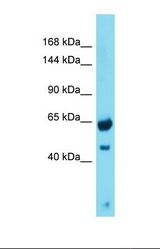 Western blot of Human Fetal Heart. GREB1 antibody dilution 1.0 ug/ml.