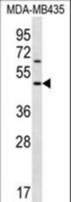 KERA Antibody western blot of MDA-MB435 cell line lysates (35 ug/lane). The KERA antibody detected the KERA protein (arrow).