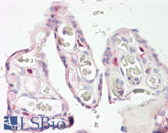 Anti-KERA / Keratocan antibody IHC of human placenta. Immunohistochemistry of formalin-fixed, paraffin-embedded tissue after heat-induced antigen retrieval. Antibody LS-B8216 dilution 5-10 ug/ml.