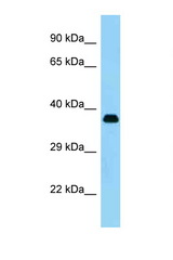 KERA antibody LS-B8216 Western blot of Small Intestine lysate. Antibody concentration 1 ug/ml.