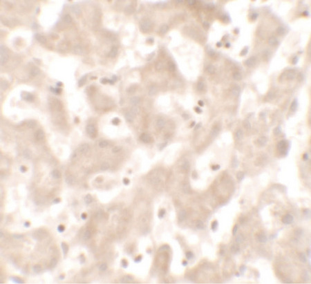 Immunohistochemistry of KHDC1 in human liver tissue with KHDC1 antibody at 5 ug/ml.