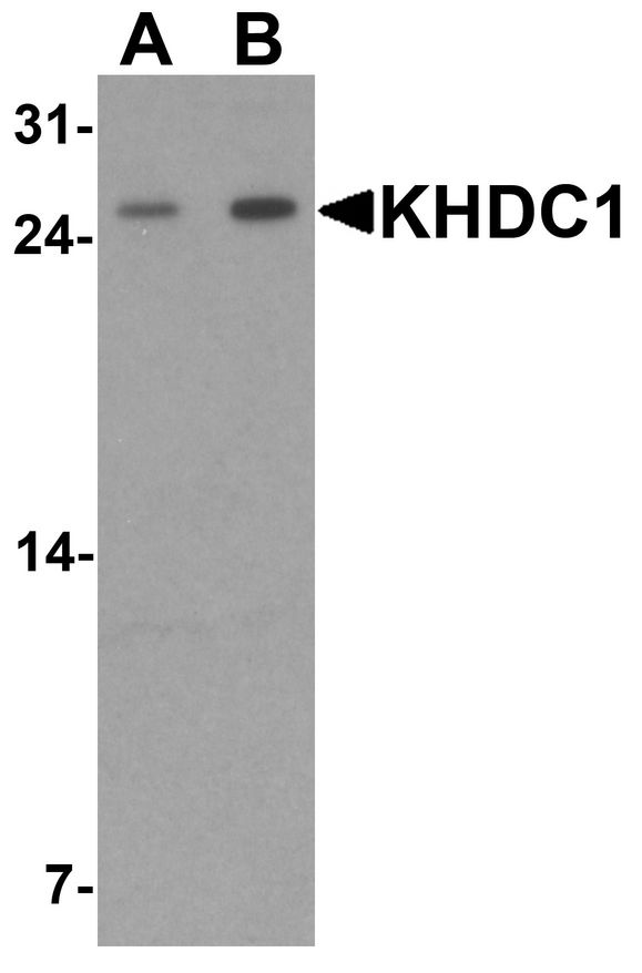 Western blot analysis of KHDC1 in rat liver tissue lysate with KHDC1 antibody at (A) 0.5 and (B) 1 ug/ml.