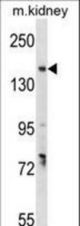 GREB1 Antibody western blot of mouse kidney tissue lysates (35 ug/lane). The GREB1 antibody detected the GREB1 protein (arrow).