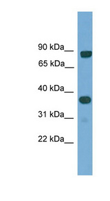 KHDRBS2 antibody LS-C117069 Western blot of Fetal Lung lysate.