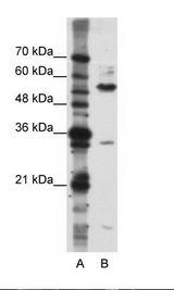 A: Marker, B: Jurkat Cell Lysate