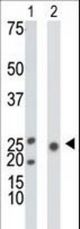 The anti-KHK antibody is used in Western blot to detect KHK in mouse liver tissue lysate (Lane 1) and 293 cell lysate (Lane 2).