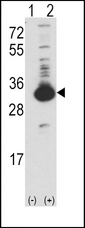 Western blot of KHK (arrow) using rabbit polyclonal Ketohexokinase (KHK) Antibody. 293 cell lysates (2 ug/lane) either nontransfected (Lane 1) or transiently transfected with the KHK gene (Lane 2) (Origene Technologies).