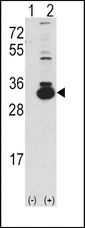 Western blot of KHK (arrow) using rabbit polyclonal Ketohexokinase (KHK) Antibody. 293 cell lysates (2 ug/lane) either nontransfected (Lane 1) or transiently transfected with the KHK gene (Lane 2) (Origene Technologies).