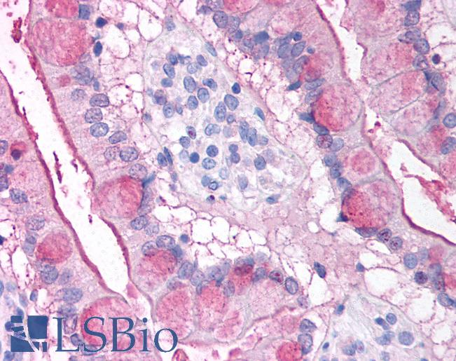Anti-Gremlin-1 antibody IHC of human small intestine. Immunohistochemistry of formalin-fixed, paraffin-embedded tissue after heat-induced antigen retrieval. Antibody LS-B810 concentration 10 ug/ml.