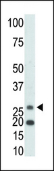 The anti-KHK antibody is used in Western blot to detect KHK in mouse kidney tissue lysate.