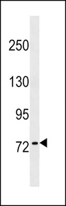 KHNYN Antibody western blot of NCI-H292 cell line lysates (35 ug/lane). The KHNYN antibody detected the KHNYN protein (arrow).