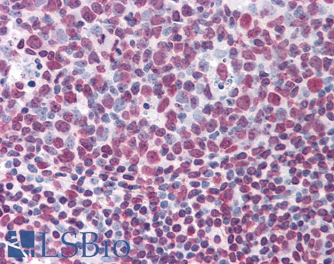 Anti-KHSRP antibody IHC of human tonsil. Immunohistochemistry of formalin-fixed, paraffin-embedded tissue after heat-induced antigen retrieval. Antibody LS-B4471 concentration 5 ug/ml.