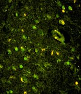 Immunofluorescence of KHSRP Antibody with paraffin-embedded human brain tissue. 0.05 mg/ml primary antibody was followed by FITC-conjugated goat anti-rabbit lgG (whole molecule). FITC emits green fluorescence.